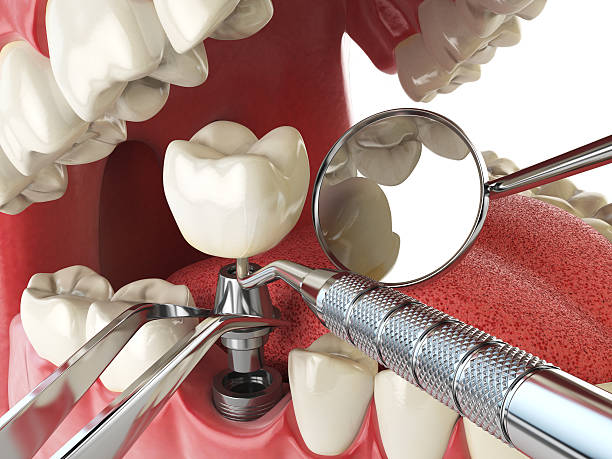 Best Root Canal Emergency Dentist  in Atkins, AR